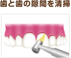 歯と歯の隙間を清掃