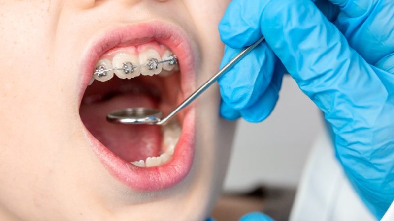 箕面市の歯医者なら痛みを少なく大切な歯を残す尾川歯科医院
