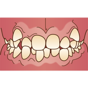 箕面市の歯医者なら痛みを少なく安心して通える尾川歯科医院