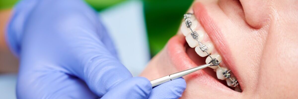箕面市の歯医者なら痛みを少なく安心して通える尾川歯科医院