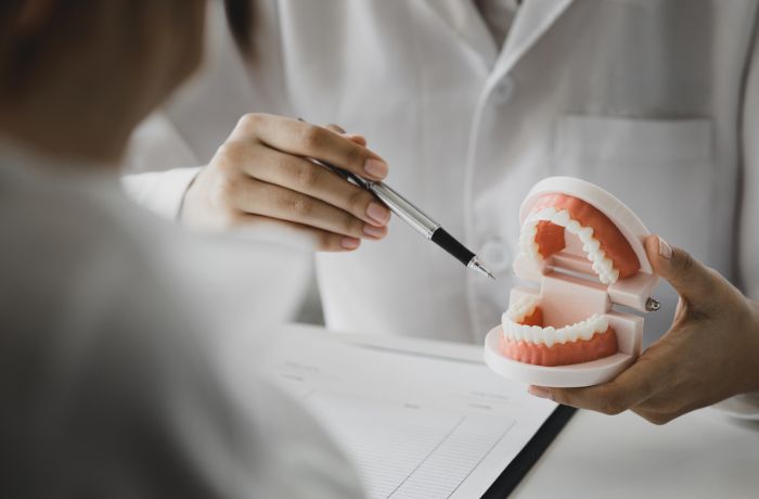 セラミックの被せ物の治療の流れ