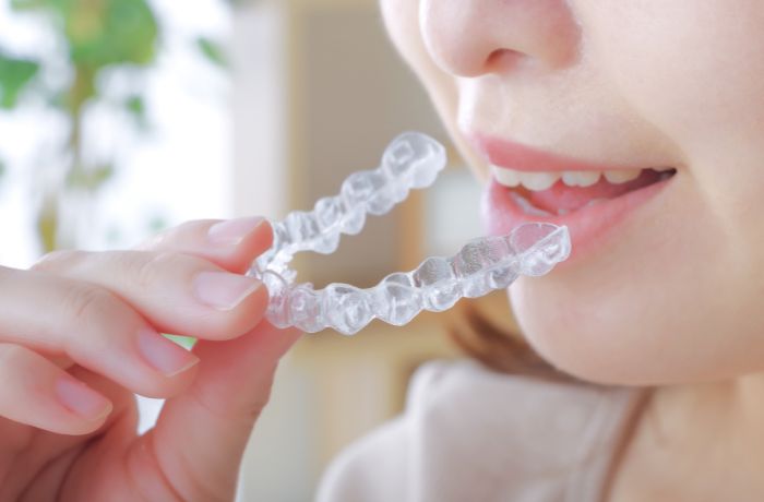 マウスピース矯正をする女性