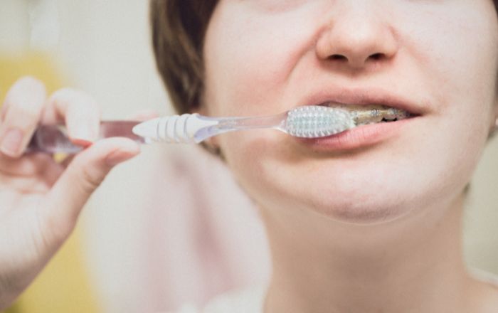 矯正治療中の歯磨き